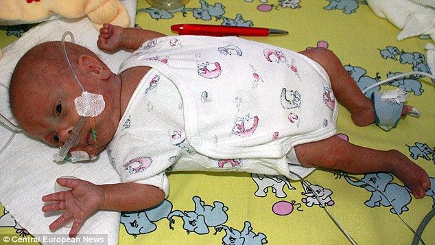 Kondisi terakhir sang bayi yang sudah dinyatakan melewati 
masa-masa kritis oleh tim dokter