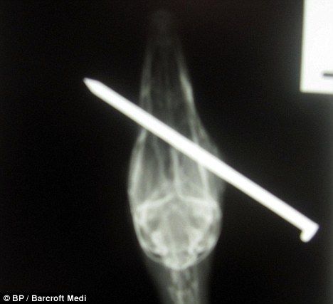 Terlihat posisi paku yang menembus kepala bebek dari sinar X-Ray 