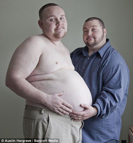 pria hamil dan melahirkan