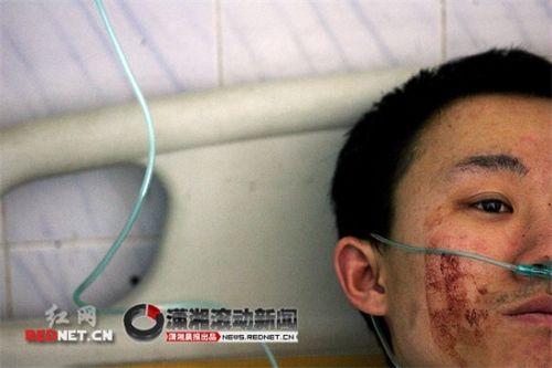 Zhang terbaring dirumah sakit dan menolak  diobati melainkan meminta dokter segera merubah kelaminnya