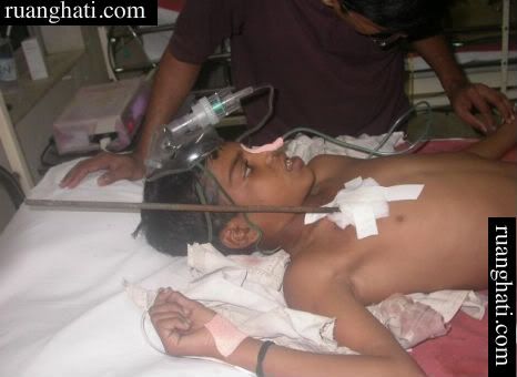 Kondisi sang bocah sembari menunggu proses operasi di sebuah rumah  sakit di Mumbai India